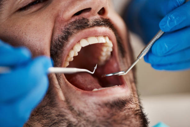 Best Emergency Denture Repair in Collierville, TN